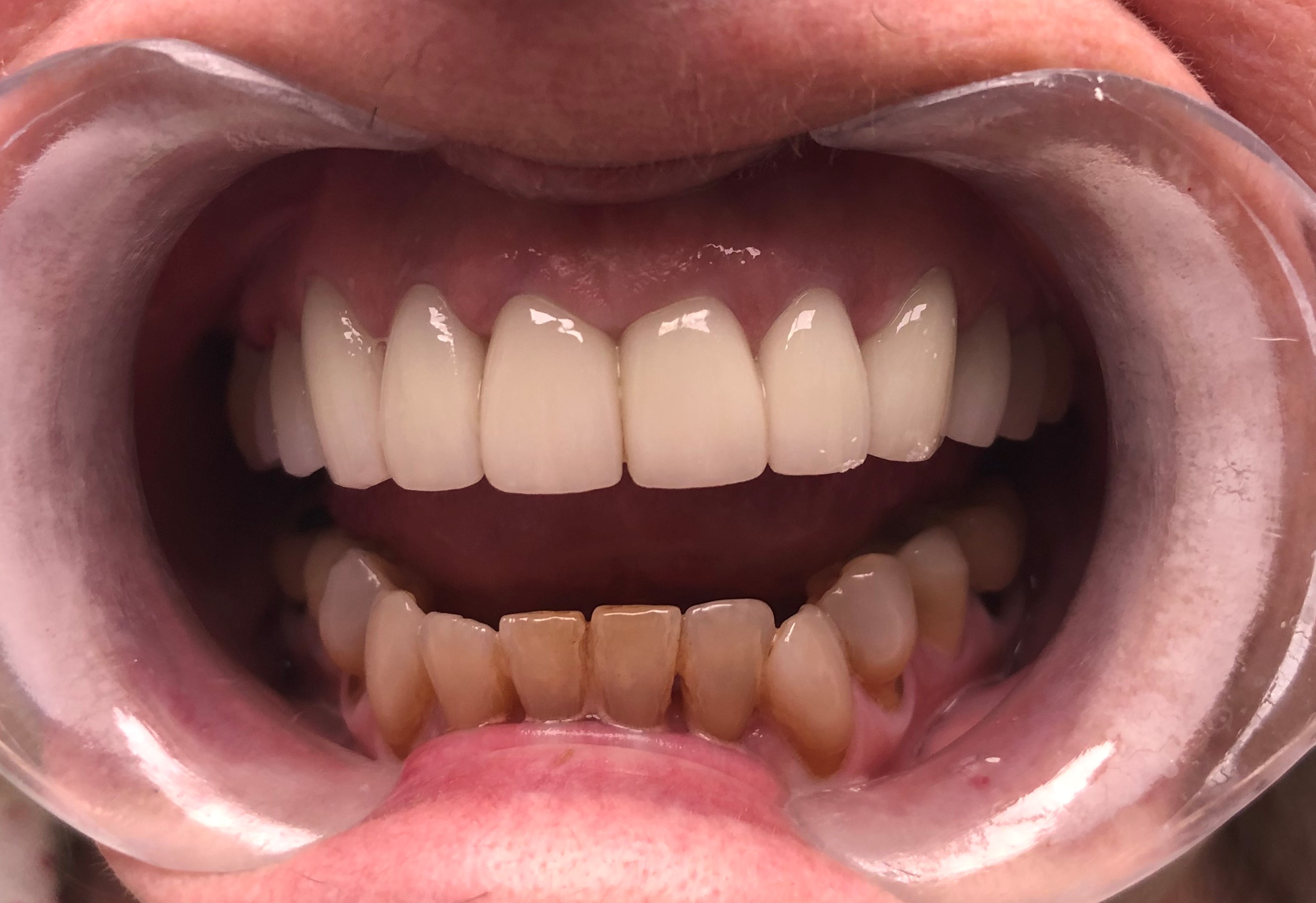 After Dr. Asya Shor, North Babylon Dental